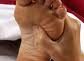Reflexology